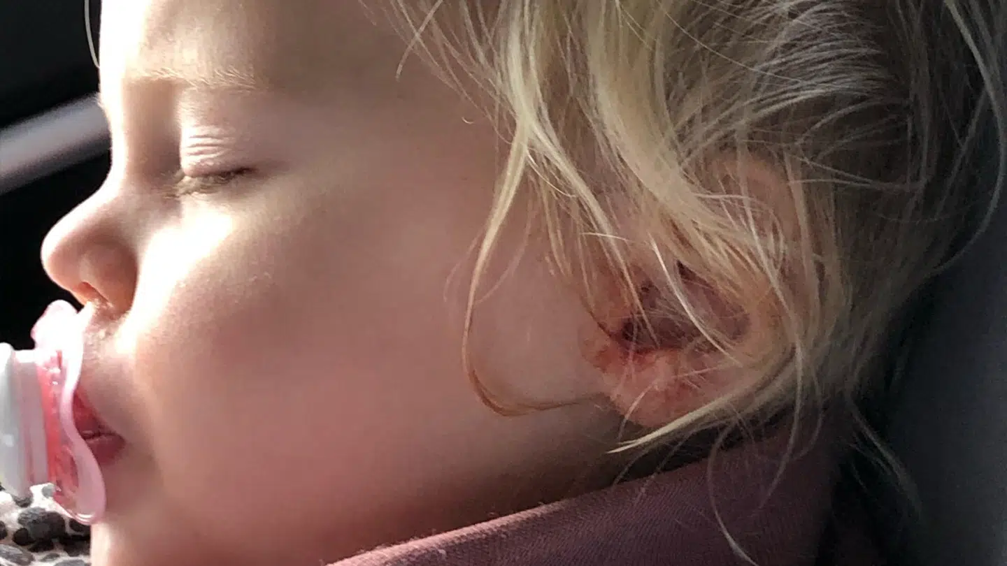 Naya på 17 måneder har ligget syg med over 40 i feber og har blødt kraftigt ud af øret, men der er ingen læge der har tilset hende ordentligt. FOTO: Mette Hemdorff