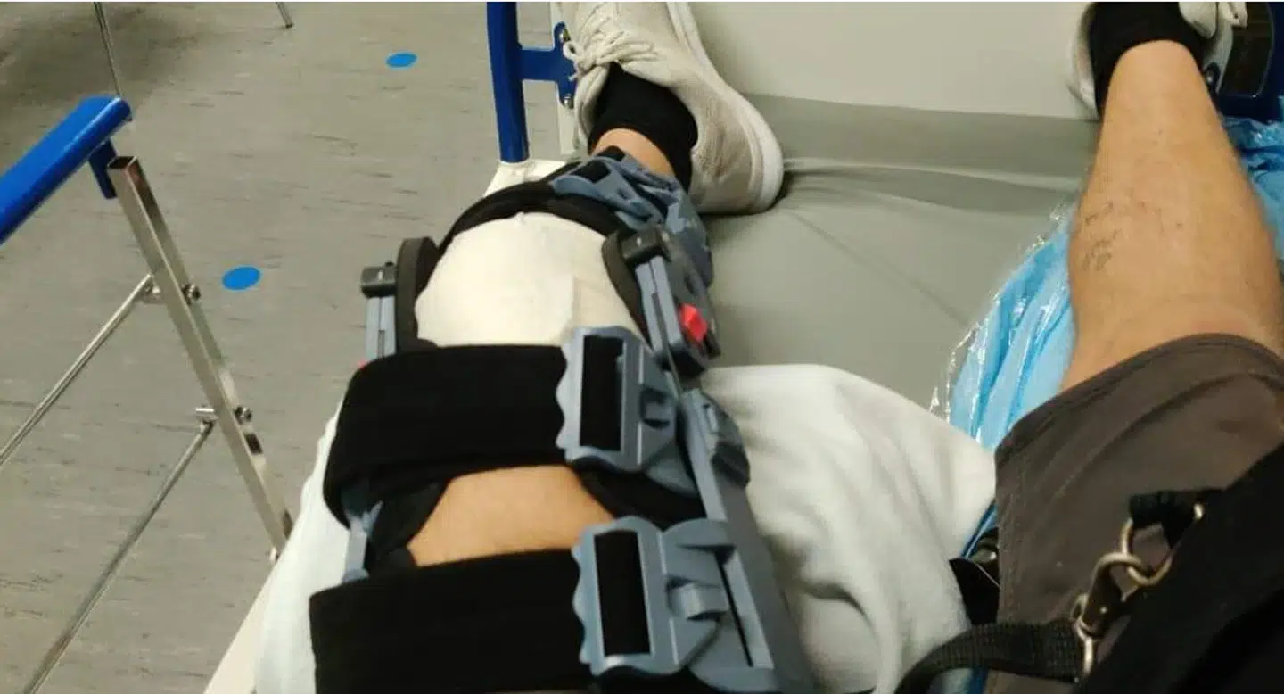 Mikkels ben efter ulykken.