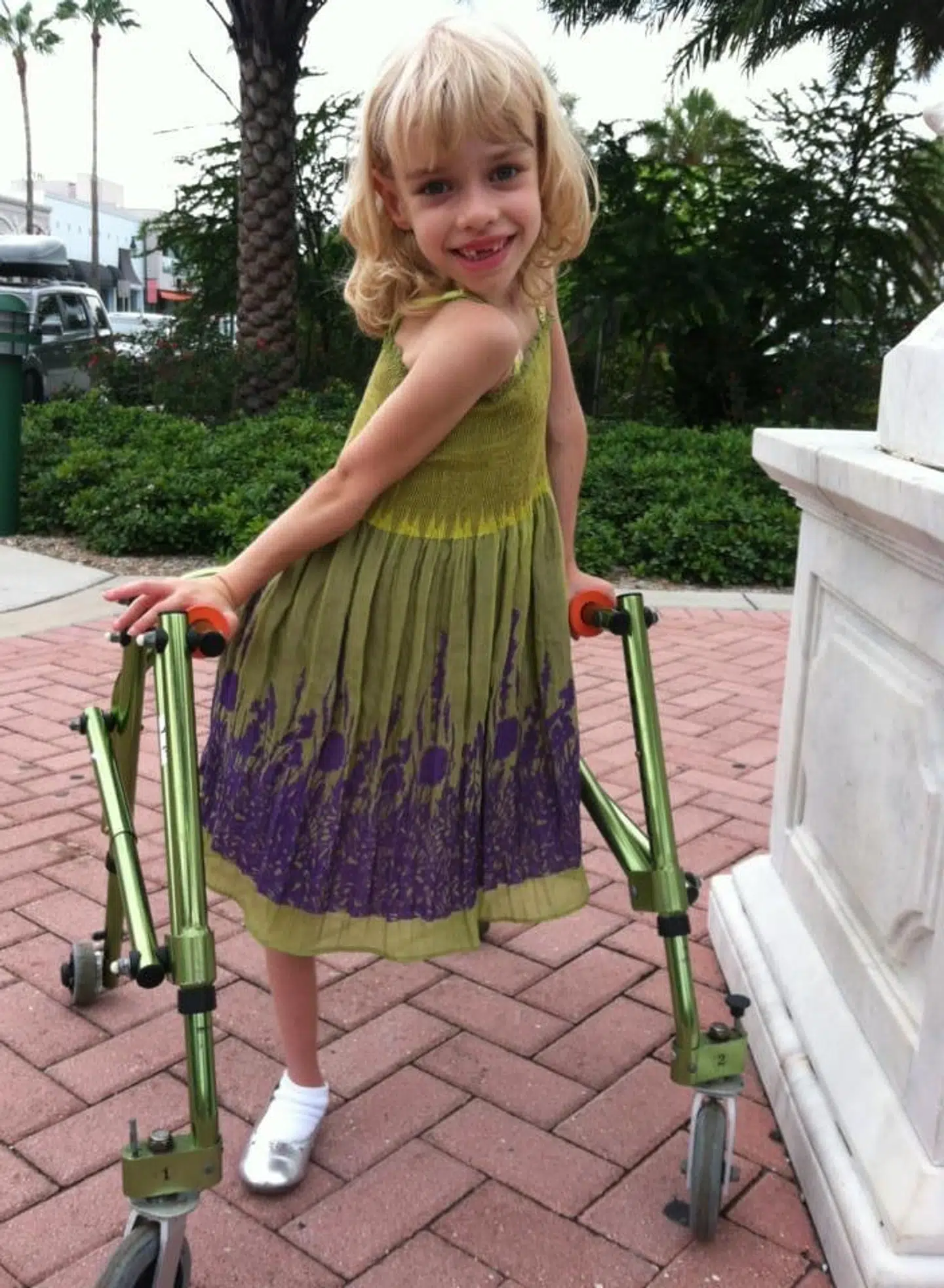 Anna-Saphia fik amputeret sit venstre ben, da hun var bare seks år gammel.