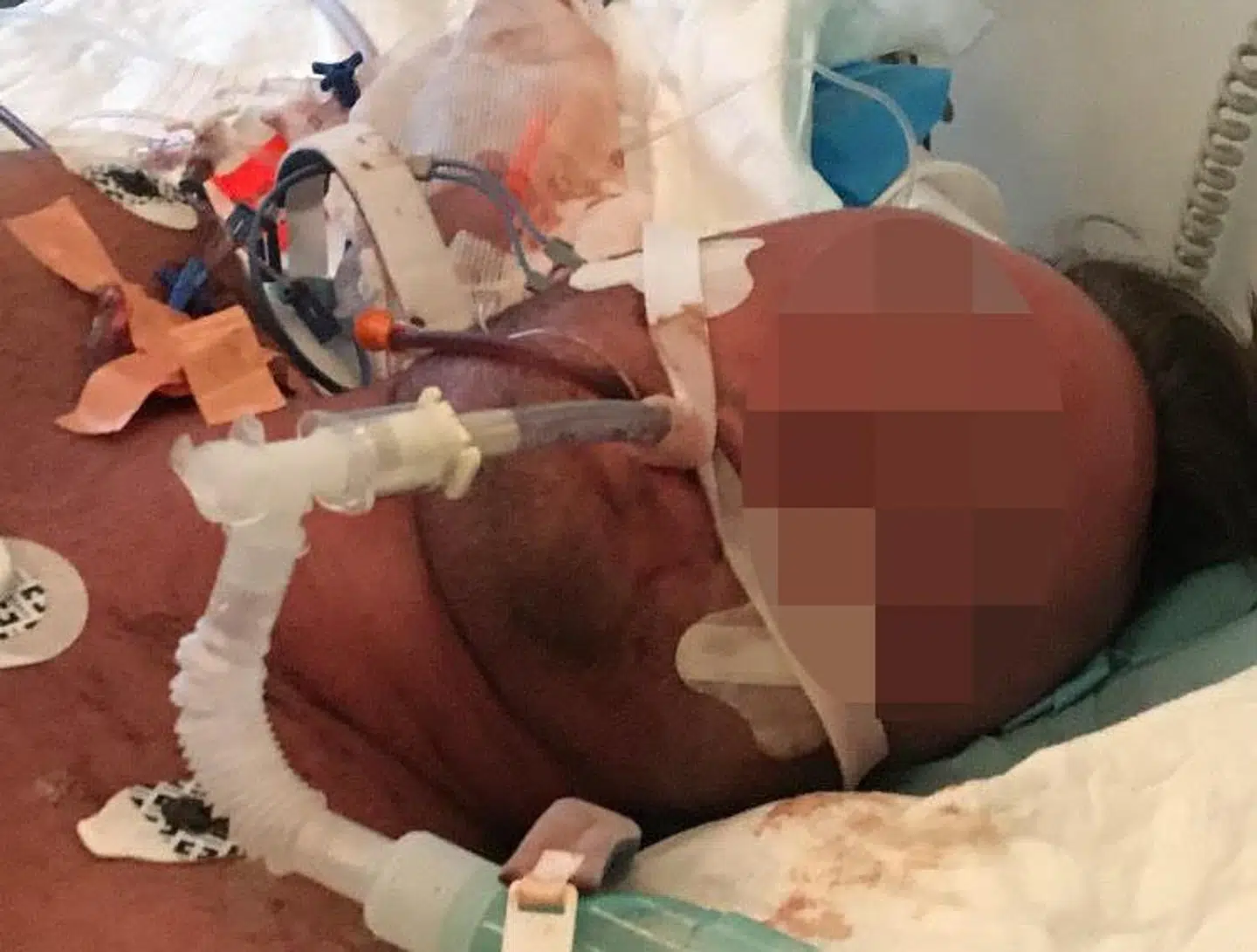 En 25-årig mand svæver nu mellem liv og død efter at være blevet skudt af politiet i den jyske by Hornslet. B.T. har valgt at sløre ham af hensyn til offeret og hans pårørende.