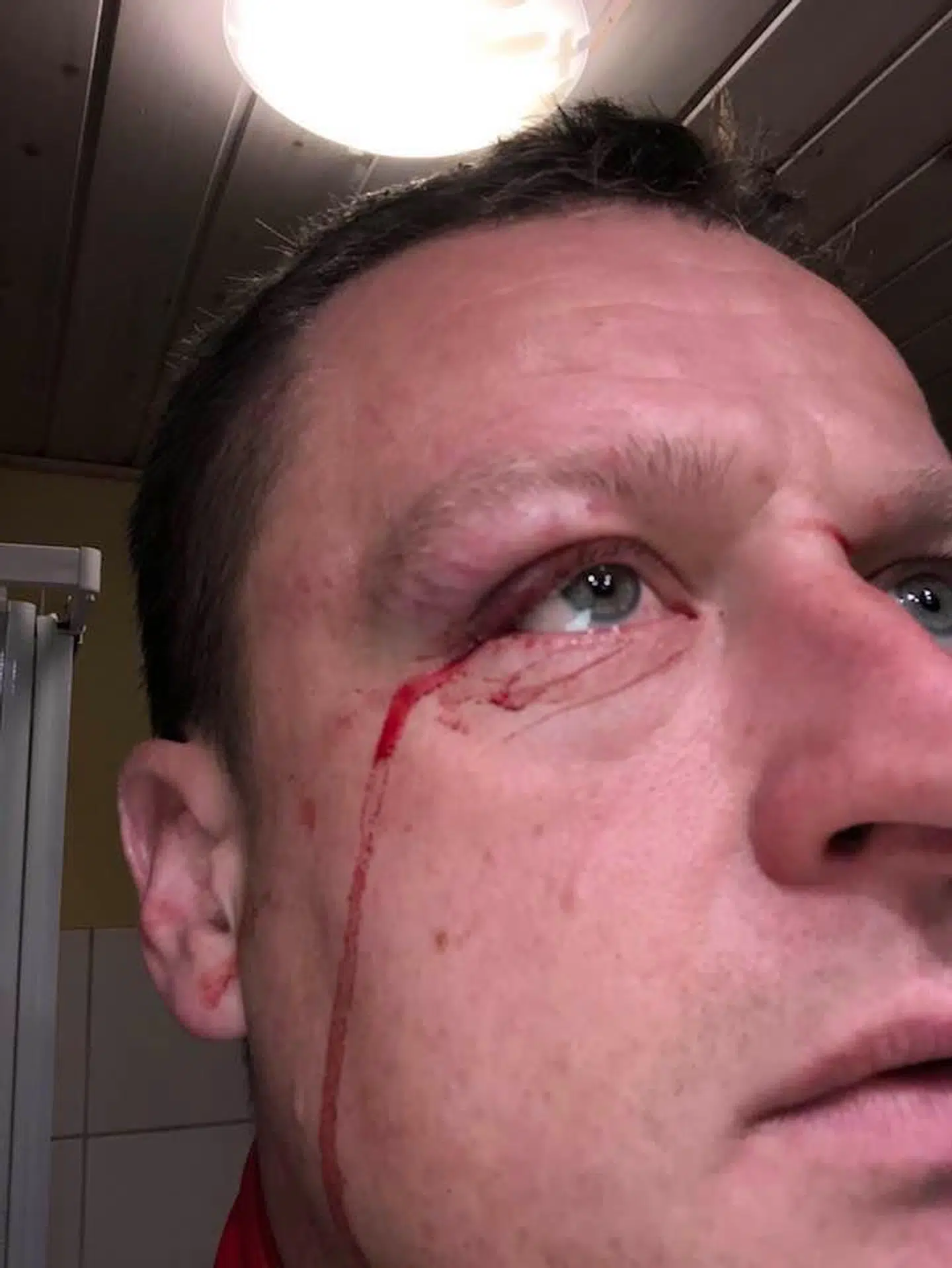 38-årige Henrik Kring måtte en tur på skadestuen, da han med høj fart var kørt ind i den udspændte nylonsnor på sin cykel.