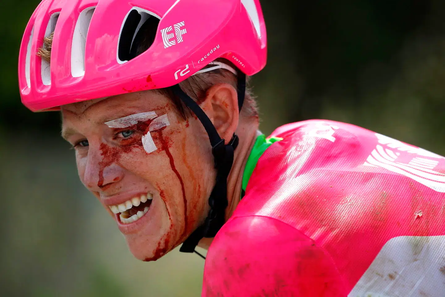 Lawson Craddock under Tour de France i 2018, hvor han gennemmførte første etape efter et voldsomt styrt.