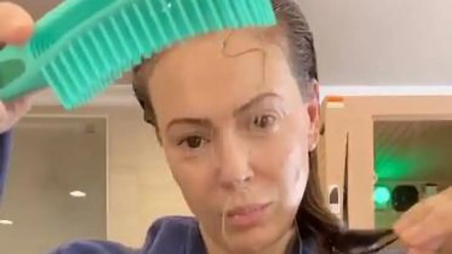 Alyssa Milano oplever ekstremt hårtab som en senfølge, fra hun var smittet med coronavirus. Foto: Instagram