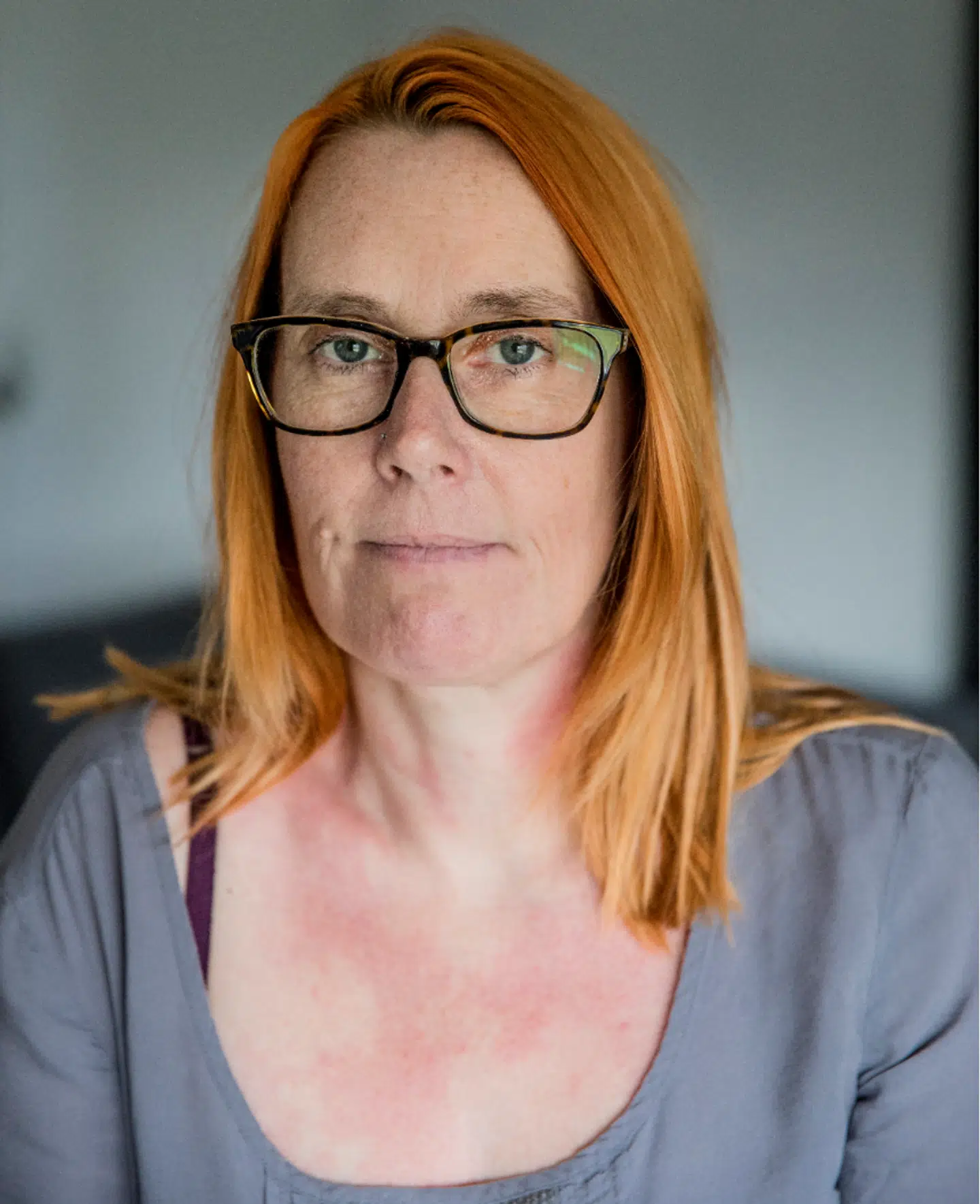 »Da operationen udsættes, og vi kommer til juli og august, lå jeg ned konstant. Jeg kunne slet ikke sidde op. Det gjorde sindssygt ondt i benet. De sidste måneder har været ulidelige,« siger 46-årige Tina Jensen. Foto: Nikolai Linares/Byrd.