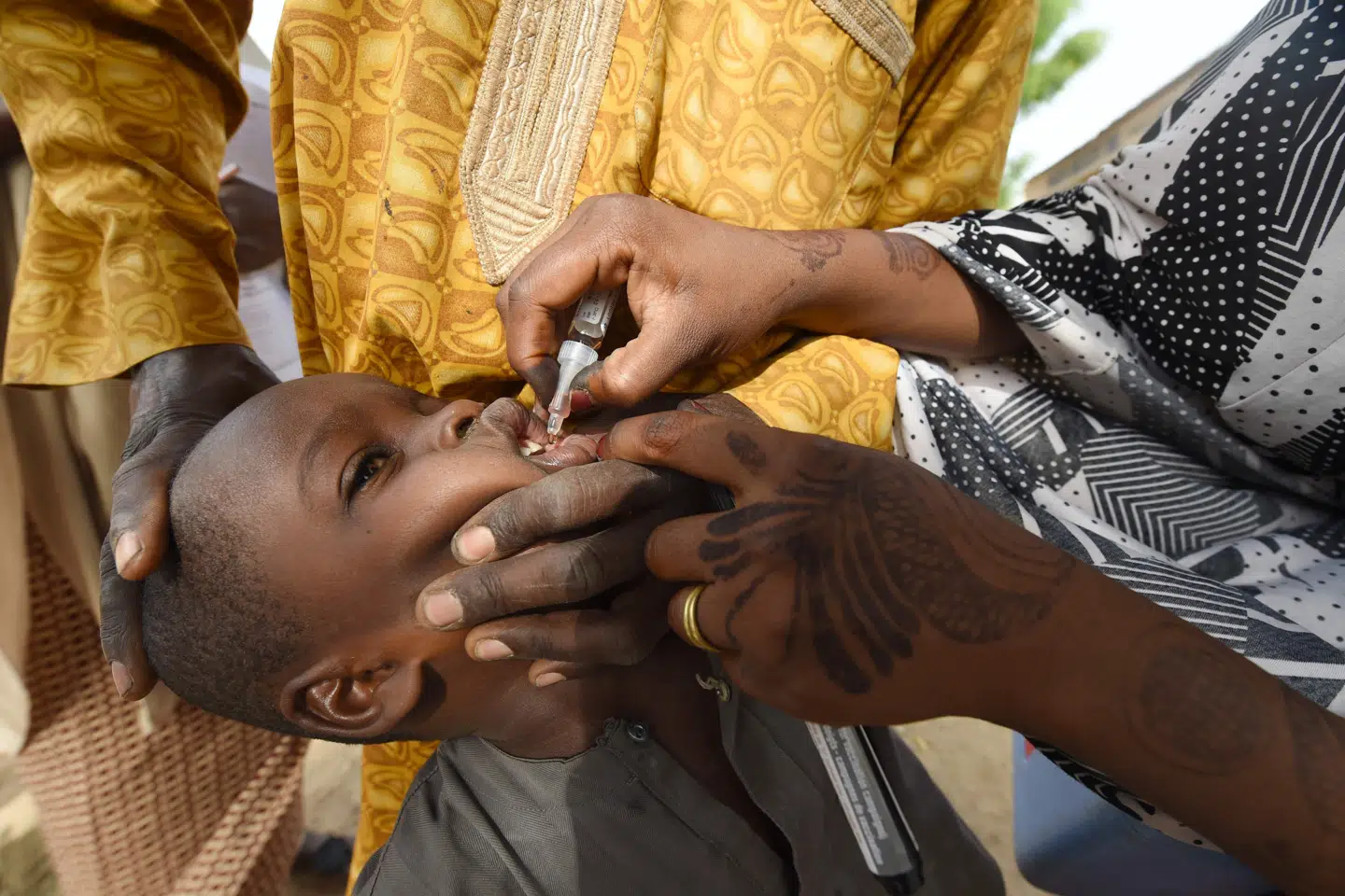 Det afrikanske kontinent lægger flere årtier med den smitsomme sygdom polio bag sig. Men både covid-19 og en ny form af polio truer fremtidens bekæmpelse. Her ses et barn i Nigeria, der i 2017 blev vaccineret for polio. (Arkivfoto). Pius Utomi Ekpei/Ritzau Scanpix