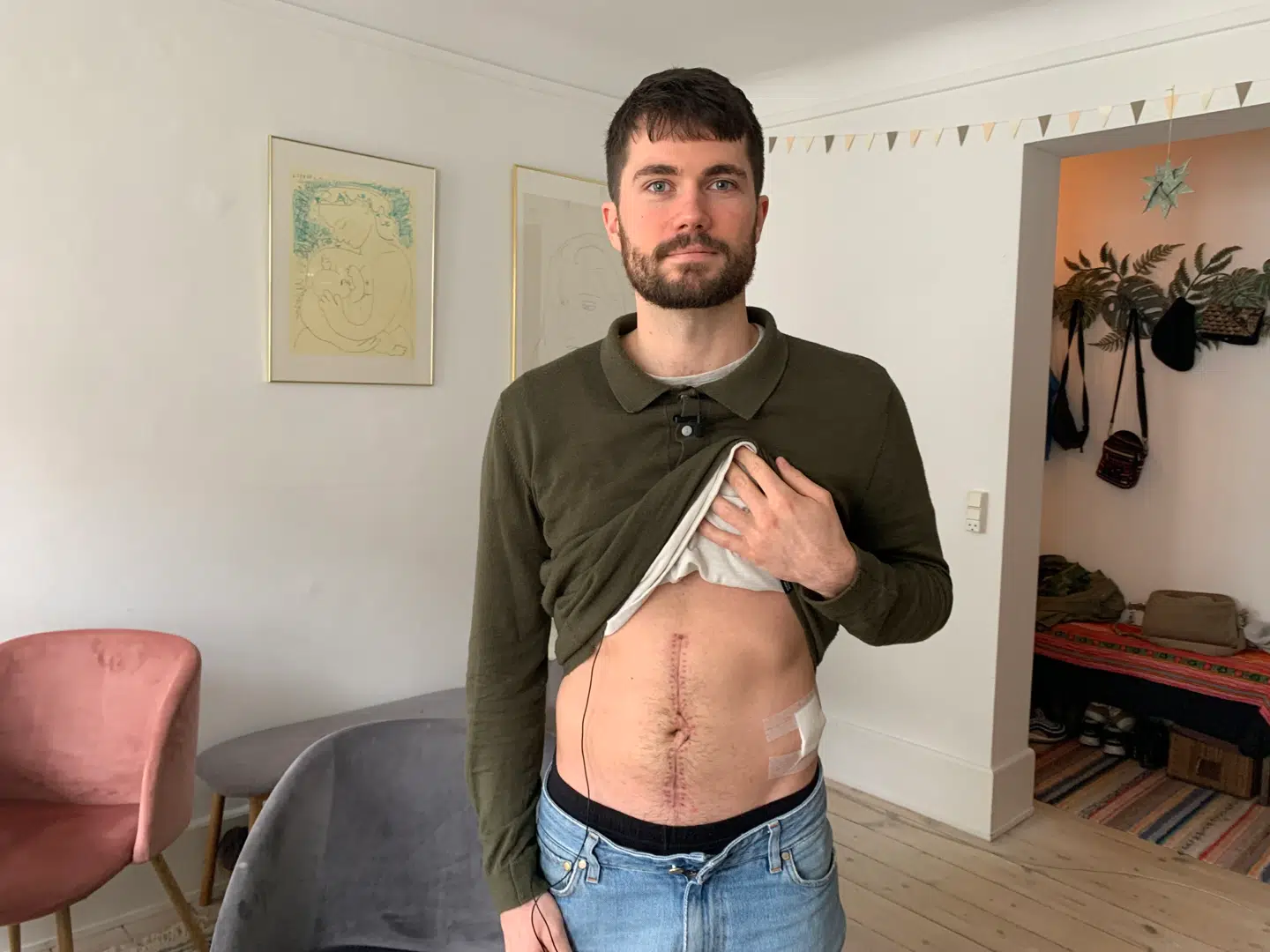 Martin Højlund en måned efter, han blev opereret i maven efter knivoverfaldet