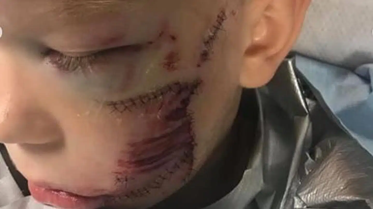 Her ses nogle af skaderne på den lille dreng.