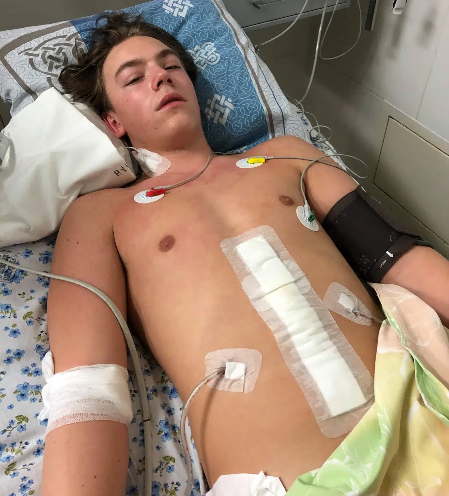 Sådan så det ud, da Kasper Larsen lå i sengen på sygehuset i Minsk dagen efter den fire timer lange operation, hvor milten blev fjernet, og han havde mistet tre liter blod.