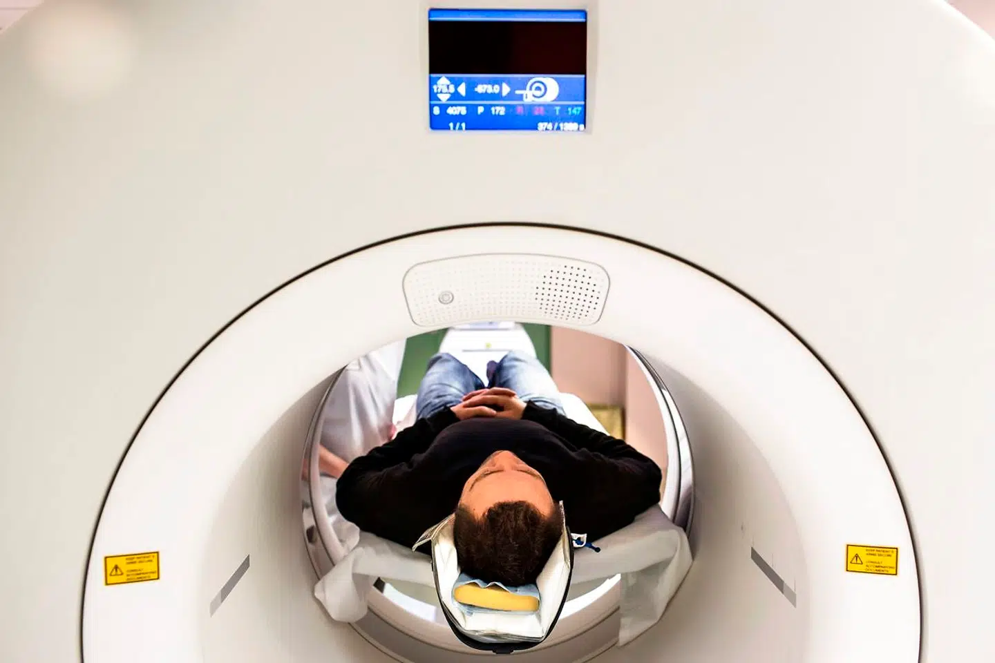 En gennemgang af 625 patientforløb viser ifølge hospitalsledelsen i Region Midt, at 93 patienter skulle have været henvist til en fuld CT-scanning med kontrast frem for den lovdosis CT-scanning, de fik på Diagnostisk Center i Silkeborg.