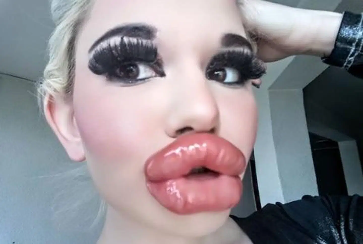 Andrea Ivanova vil have verdens største læber.