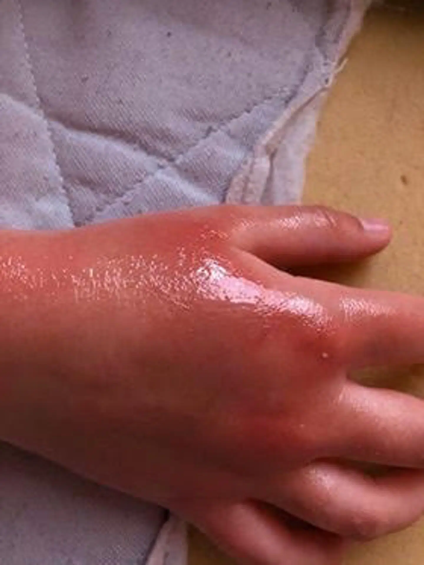 Camilla Møllers datters hånd.