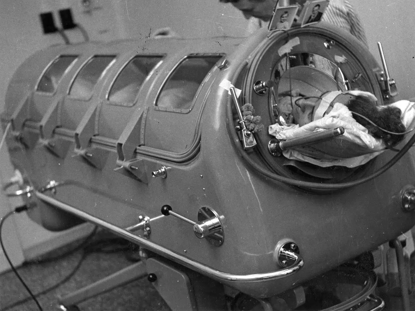 På Blegdamshospitalet havde man kun én respirator - den såkaldte ‘jernlunge’. ‘Jernlungen’ fungerede ved, at hele patientens krop undtagen hovedet var inde i stålrøret, og så brugte man skiftevis over- og undertryk til at hjælpe patienten til at trykke brystkassen ind og ud. Foto: Medicinsk Museion, Københavns Universitet