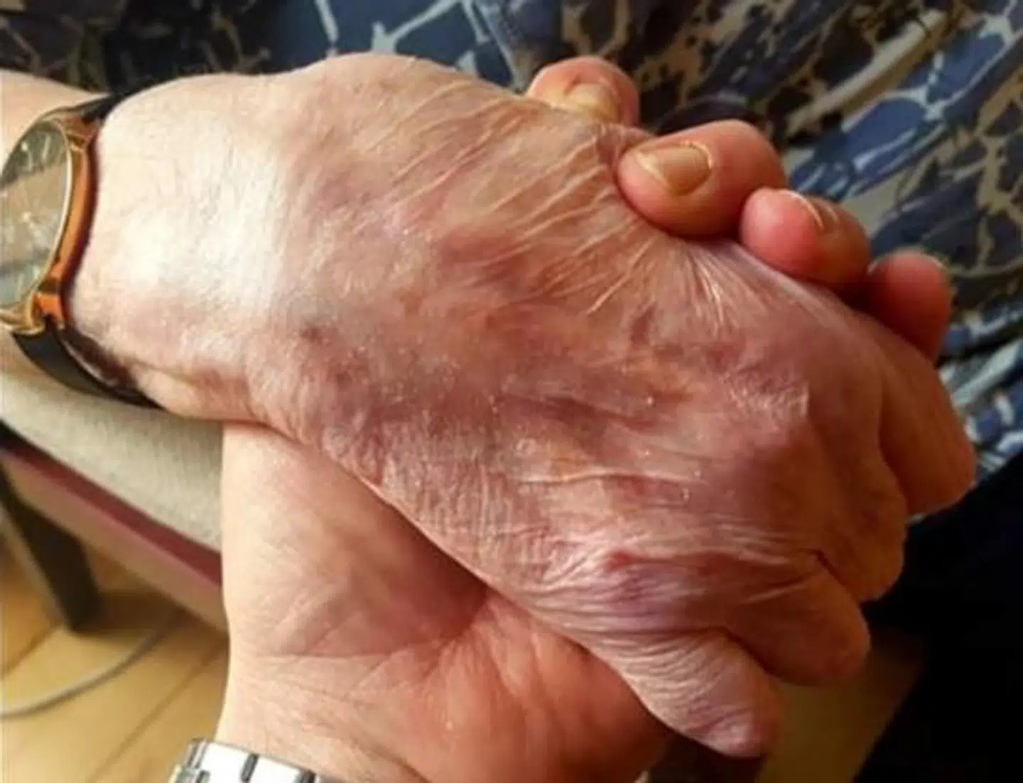 »Det synes jo som et luksusproblem, at jeg ikke kan besøge min mor, når mennesker ligger og dør i verden, men det har jo stor betydning for den enkelte,« siger Frank Gardner Peters.