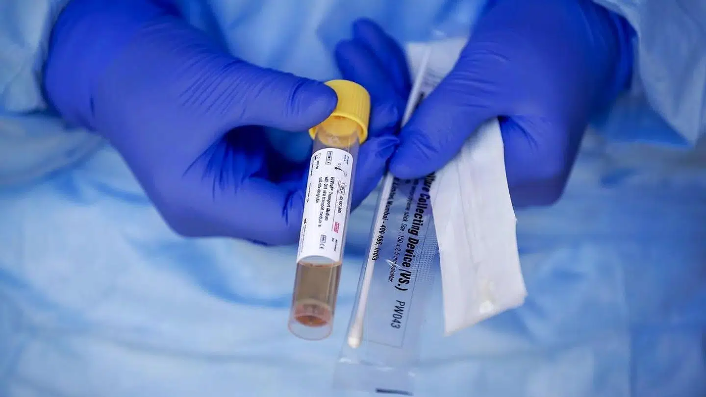 Testkit for coronavirus.