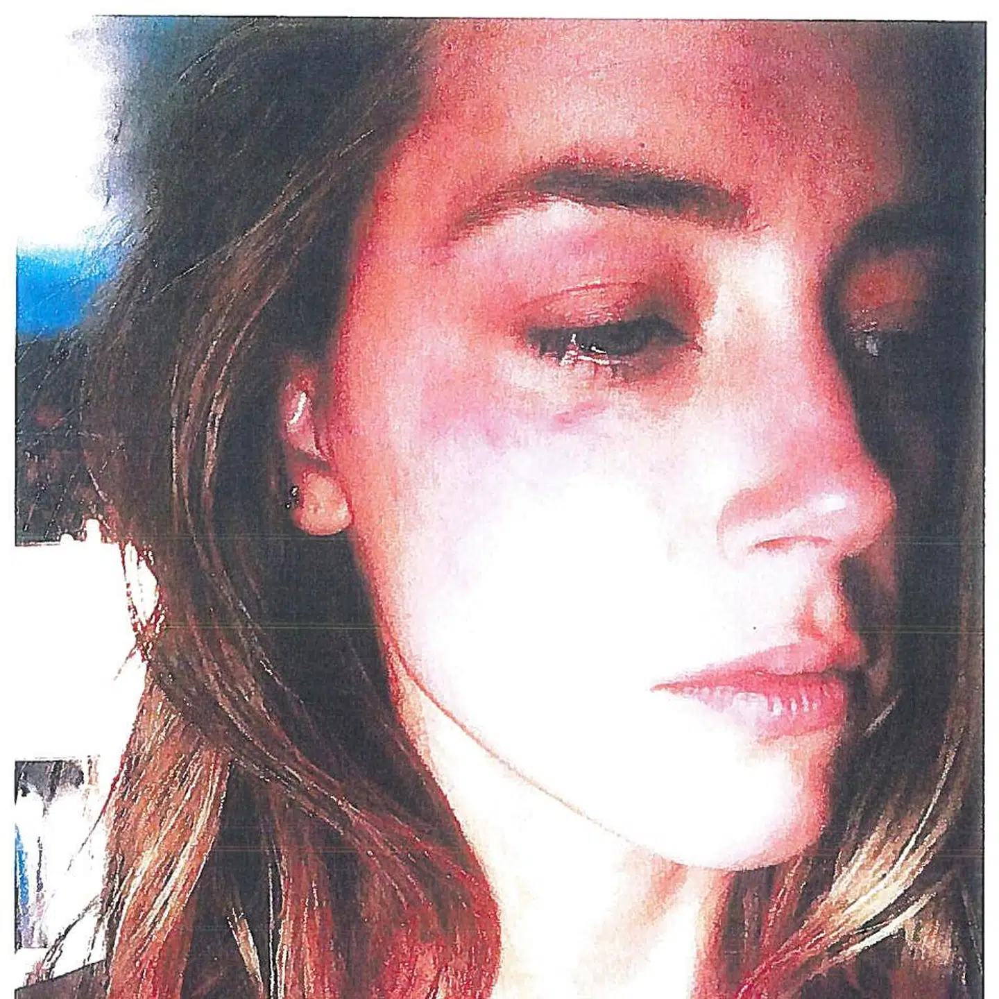 Billede offentliggjort i retten, hvor Amber Heard forsøgte at få et tilhold imod sin eksmand, skuespiller Johnny Depp.