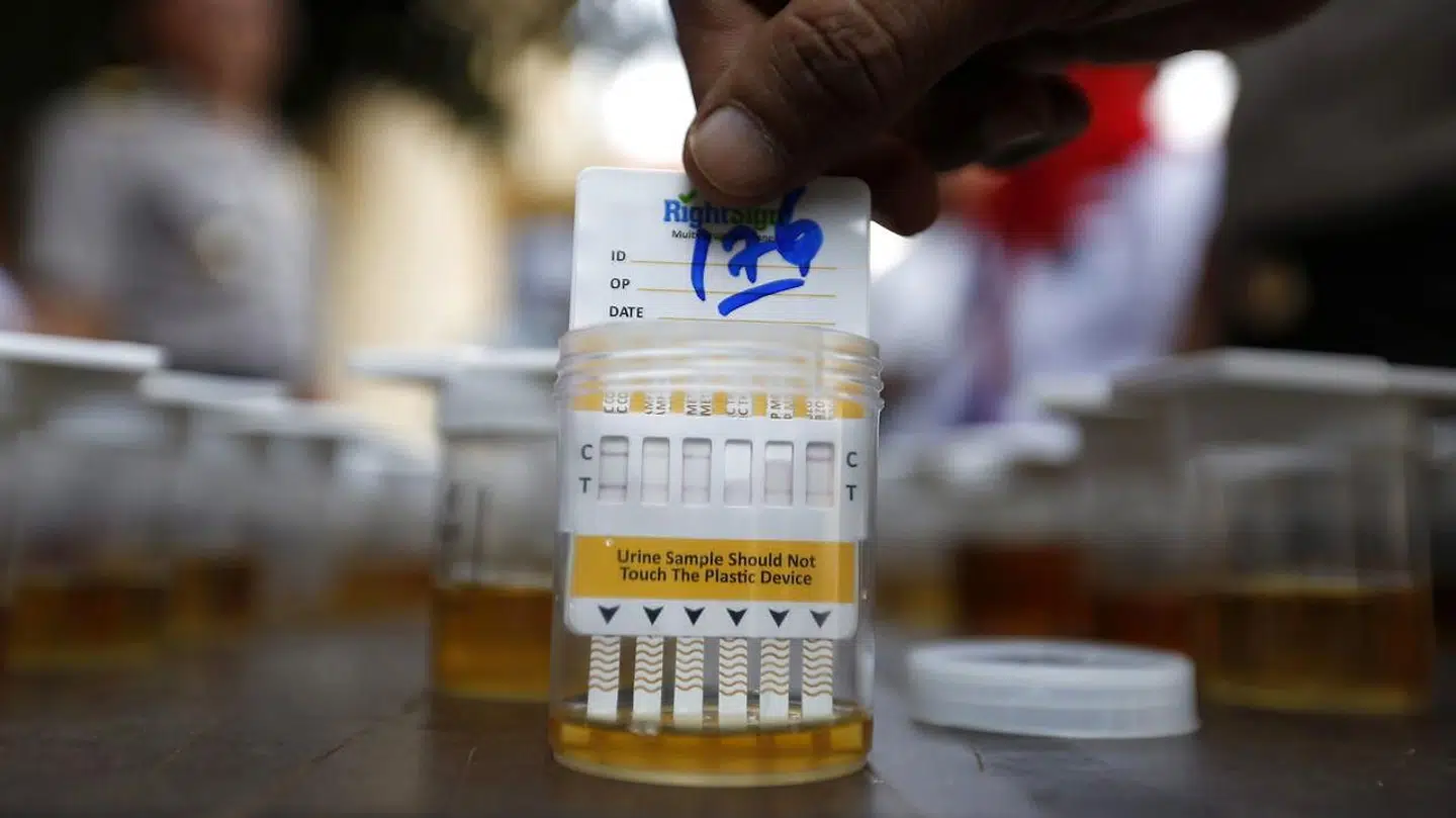 Urinprøve. Arkivfoto.