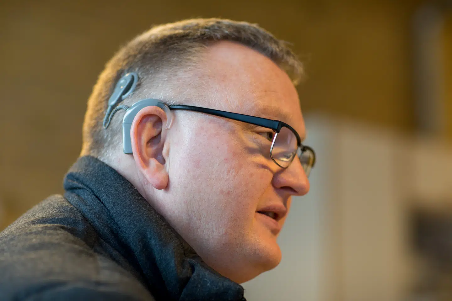 Sådan ser det ud. Implantatet består af to dele. En elektrode indopereret i Erik Thonkes baghoved, der er direkte forbundet til hørenerven, og en lydprocessor, der med en magnet clipses fast på baghovedet, når han skal høre.