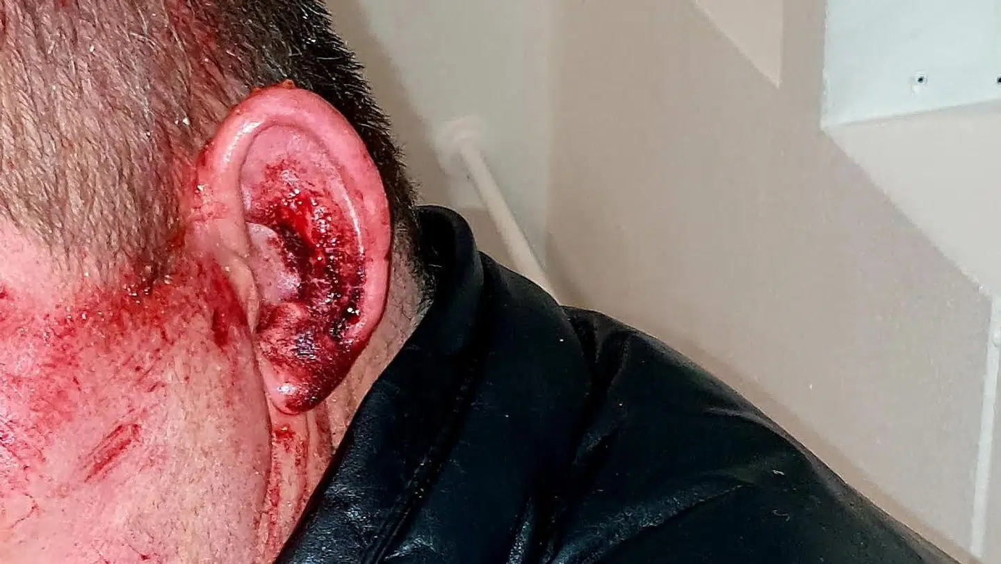 Rosas kæreste slap fra overfaldet med et blodigt øre.