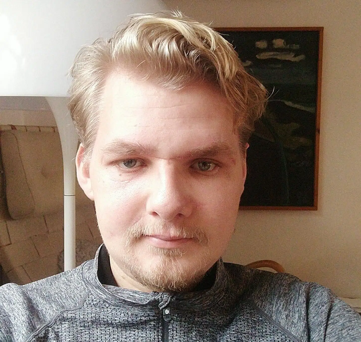 Peter i dag. Han er 'sluppet' med et mistet øje og flere ar i ansigtet.