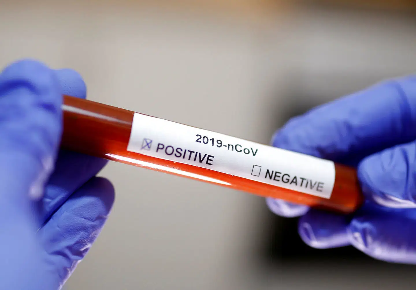 Test tube with Corona virus name label is seen in this illustration taken on January 29, 2020. REUTERS/Dado Ruvic
