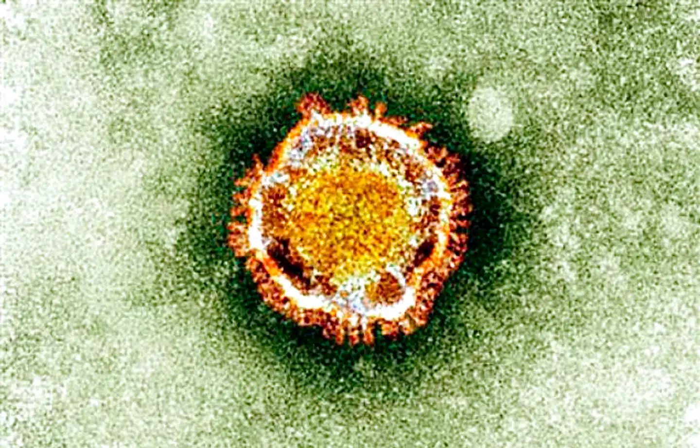 Coronavirus set i et mikroskop. På billedet ses ikke det virus, der er fundet i det aktuelle udbrud i Kina, men en variant af virussen.