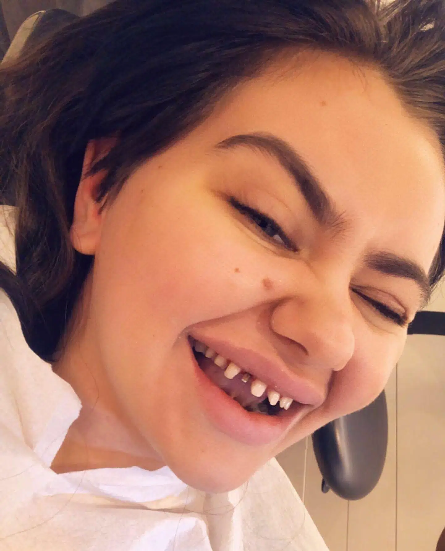 Fie Laursen bliver kaldt en dårlig rollemodel flere steder, efter hun blandt andet har reklamere for at få filet sine tænder ned og sat falske på. (Privatfoto)