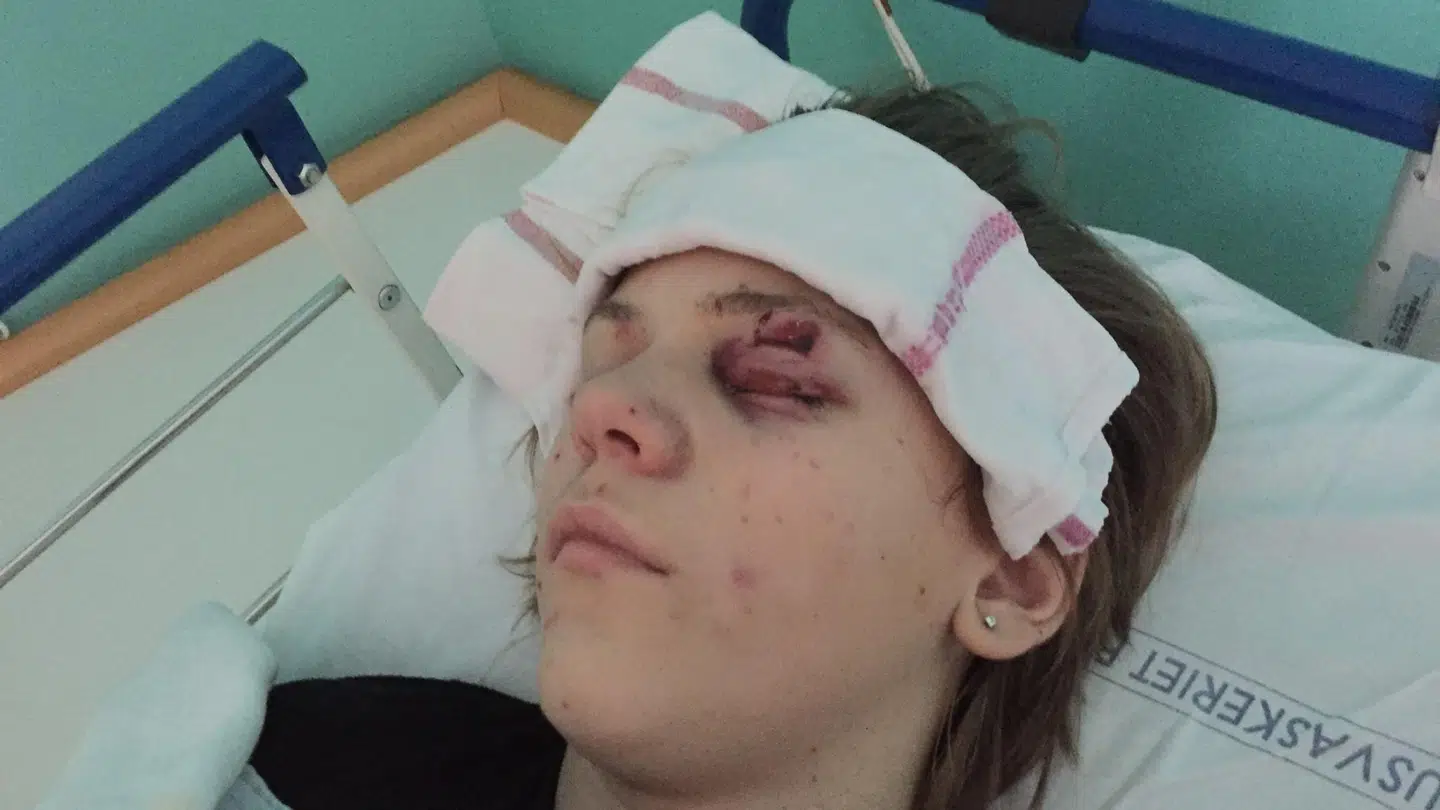 Peder Gejl efter ulykken. Foto: Privat.