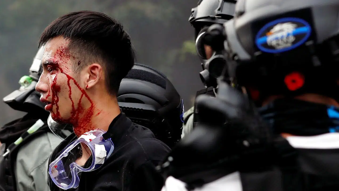 Demonstranter er også blevet såret i forbindelse med kampe mod politiet.