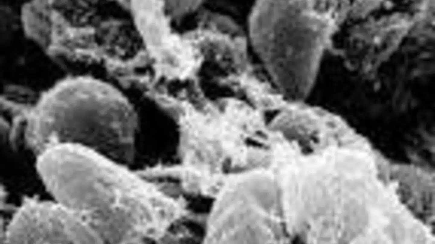 Pestsmitten under et mikroskop Foto: Pxhere.com