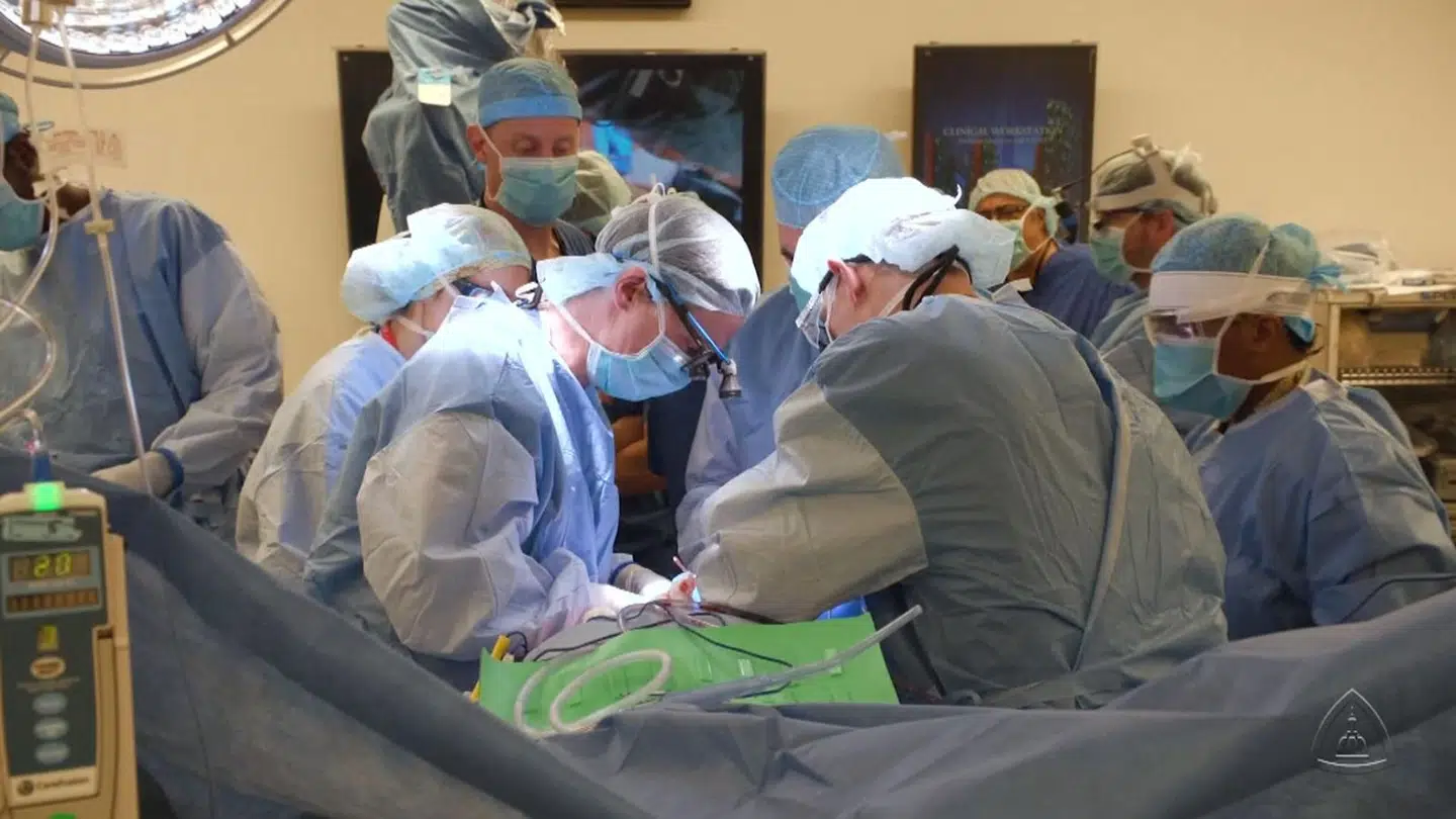 Det tog kirurgerne 14 timer at udføre operationen.