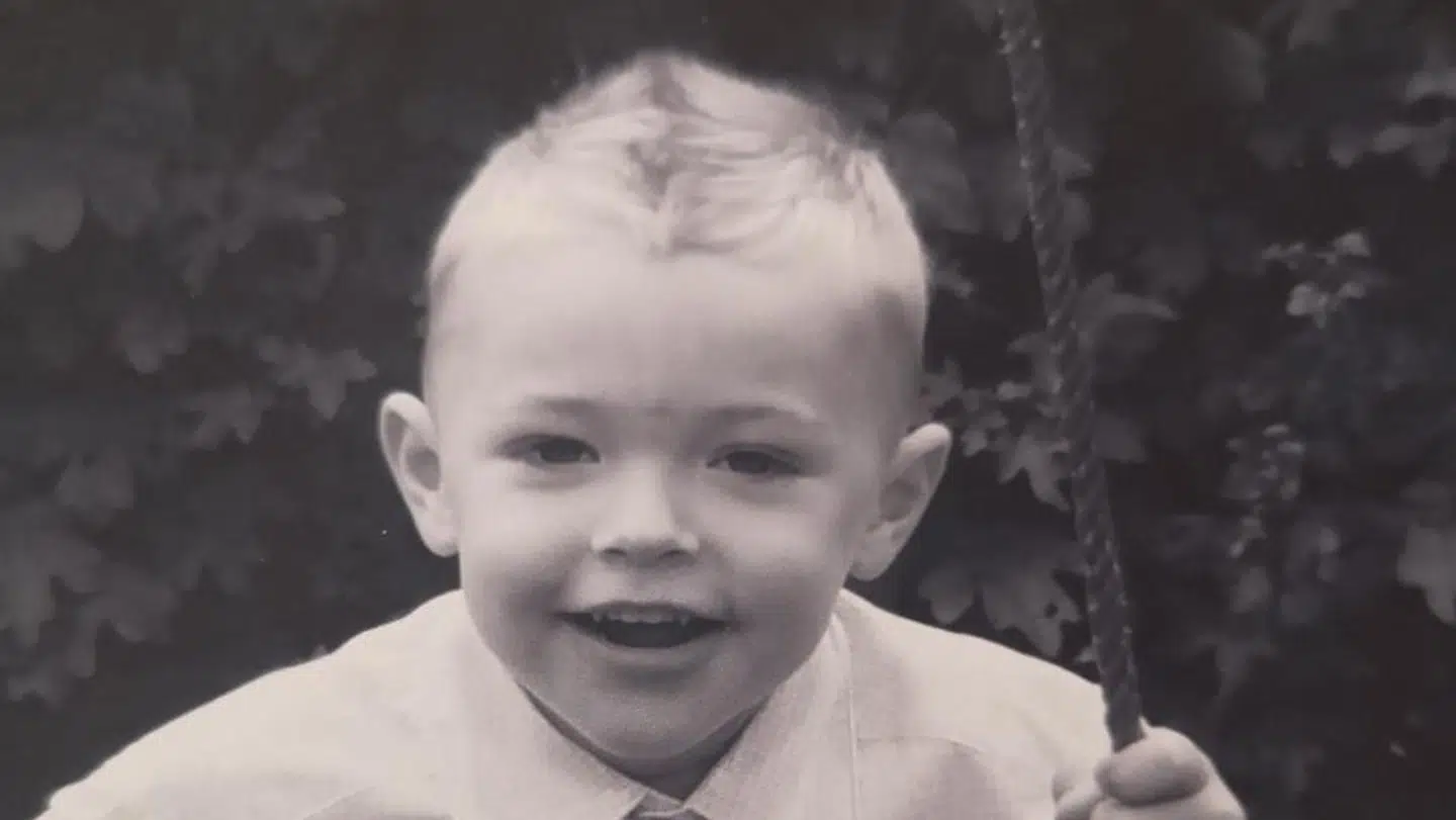 Som treårig fik Noah et ar i panden, som også kan ses på dette billede.