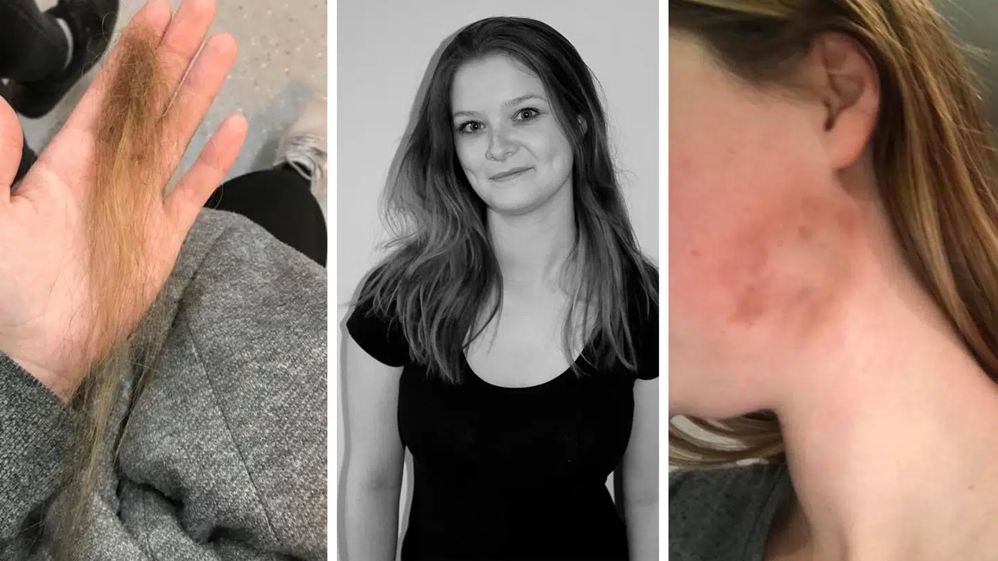 Janni blev overfaldet i november, men politiet har valgt at standse efterforskningen.