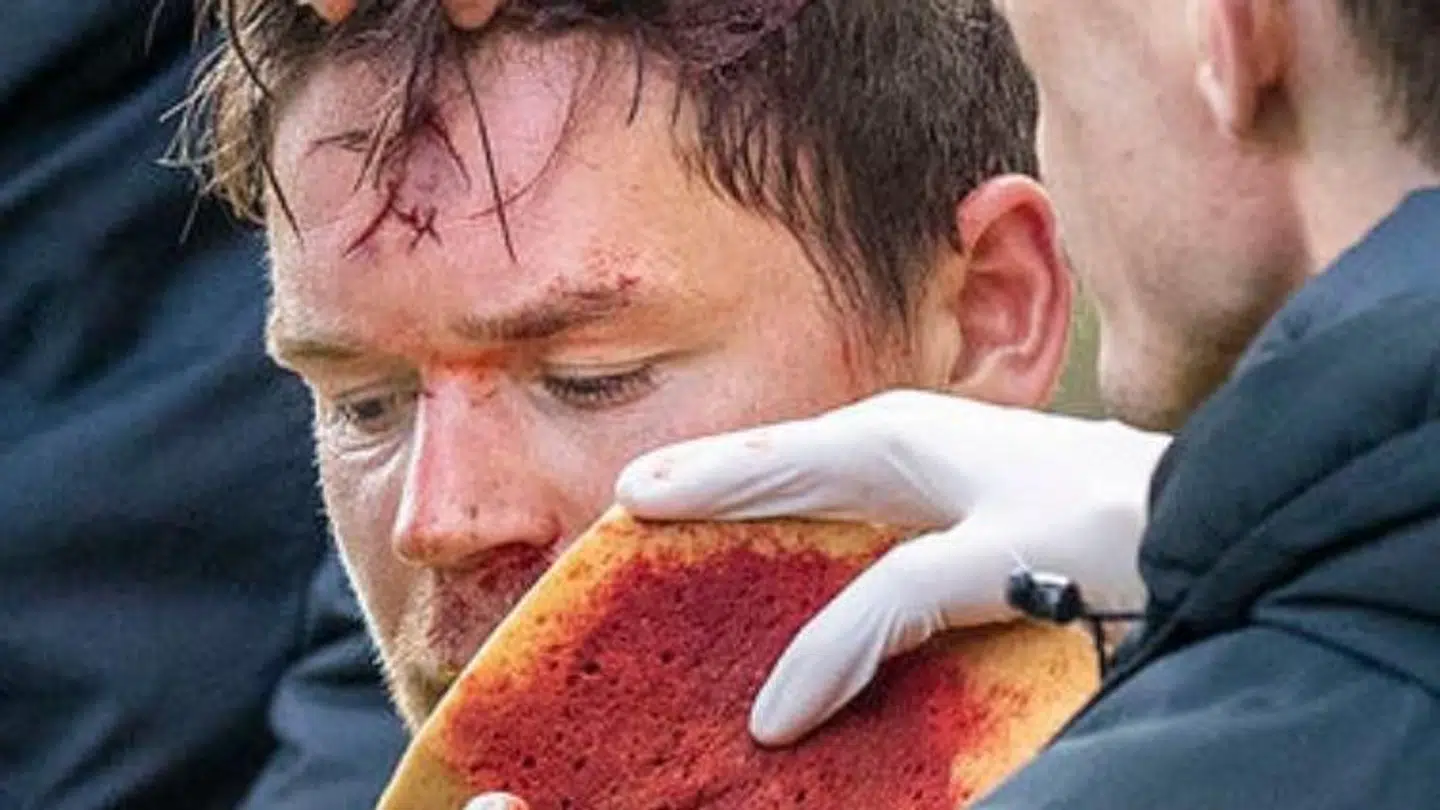 Dominik Kaisers pande var hårdt medtaget søndag.