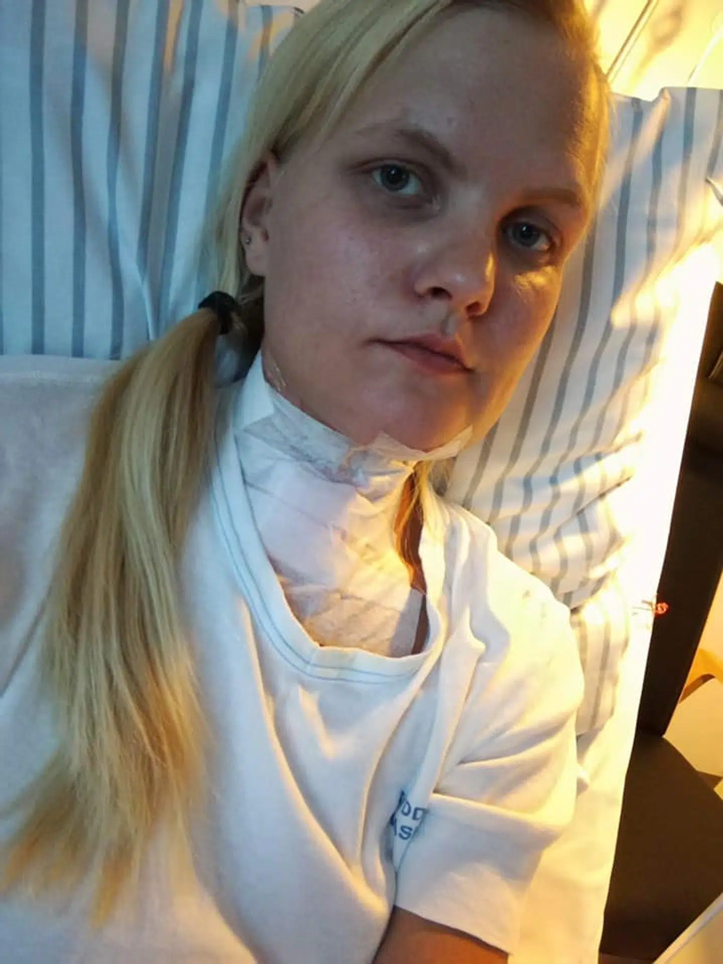 26-årige Louise blev overfaldet 2. september i sit hjem. Nu har familien startet en indsamling.