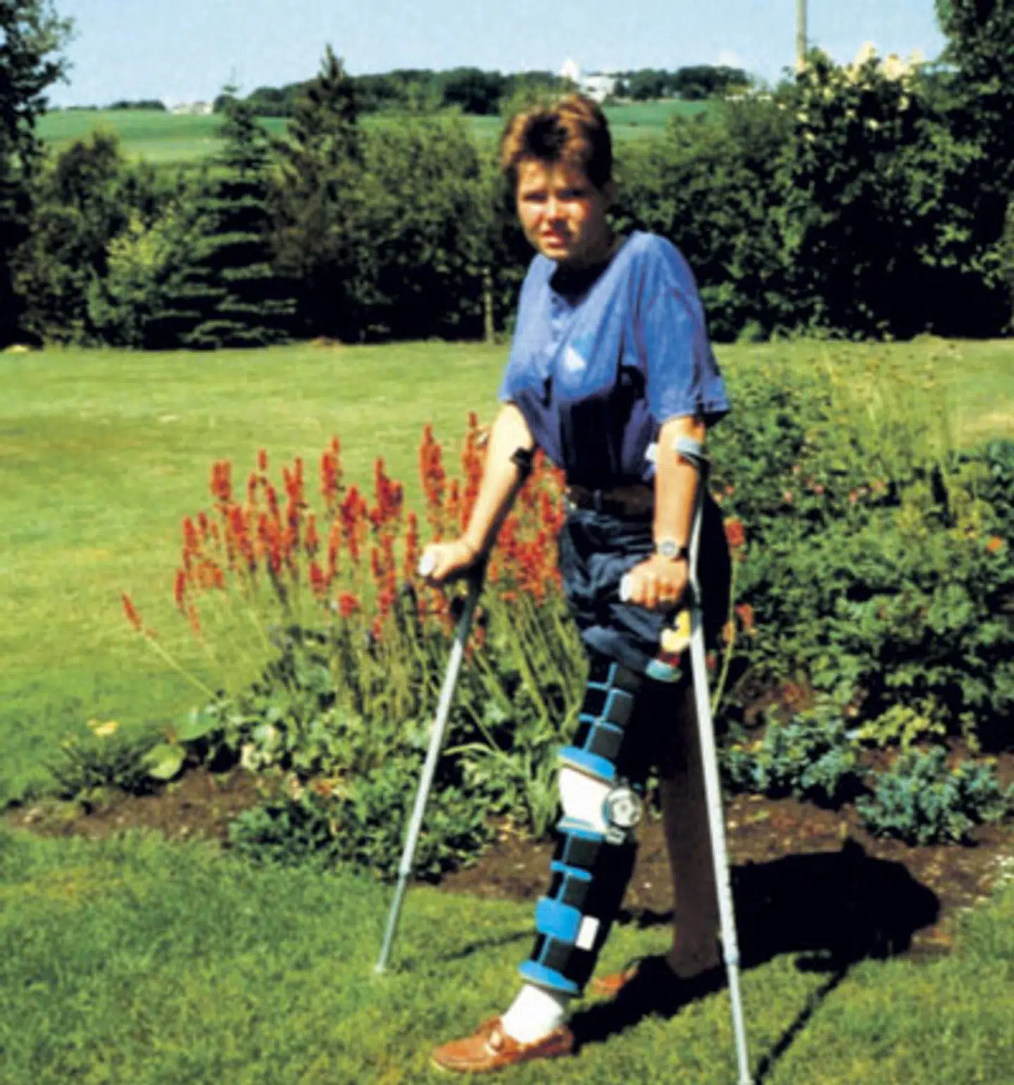 »En knæskade er grunden til, at jeg i dag er politiker«