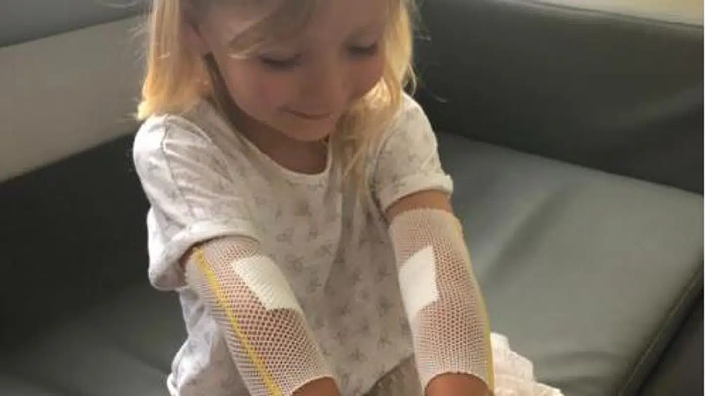 Belma Topalovic, der er mor til treårige Mia Nielsen, opfordrer folk til at gå til lægen med deres børn, hvis de er i tvivl.