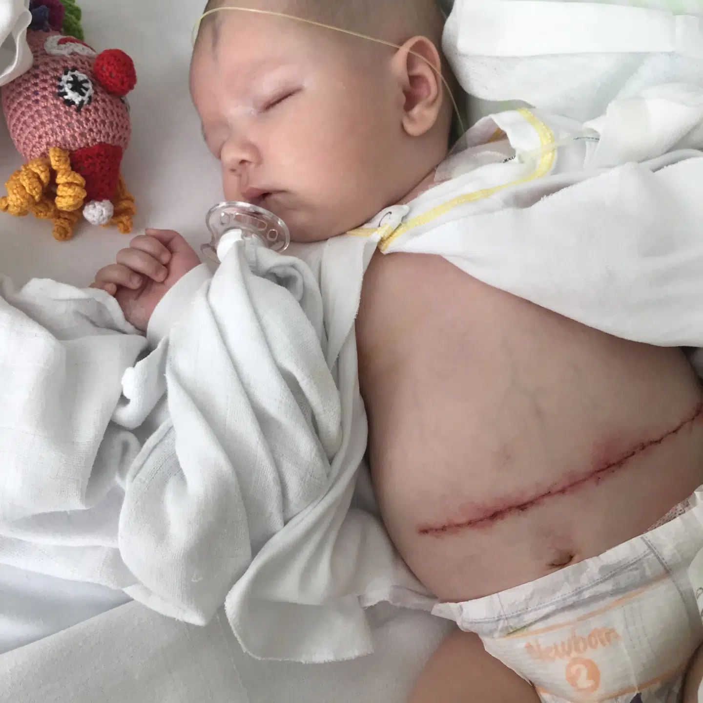 Emilio efter operationen.