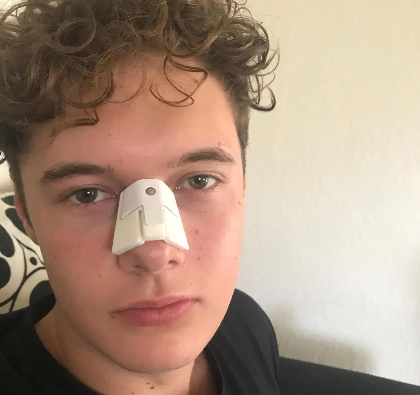 Silas Lund blev overfaldet 29. marts sidste år efter en bytur. Han endte med en brækket næse, en hjernerystelse og tandskader. Han kunne i sin anmeldelse efterfølgende give politiet oplysninger om overfaldsmandens navn og adresse. Sagen er alligevel ikke afsluttet efter halvandet år.