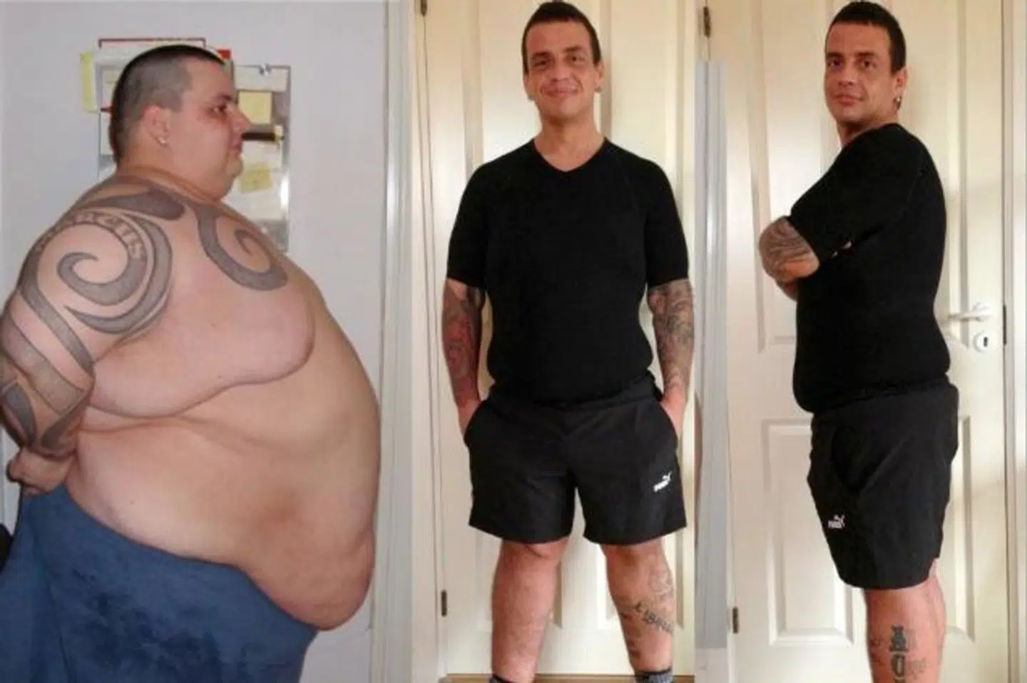 Jesper Skovshoved tabet 140 kilo i TV3 programmet 'Ekstremt fed'