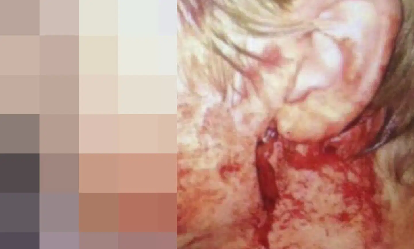 Det voldsomme billede af den unge mands skader er blevet frigivet i samråd med teenageren selv og hans familie.