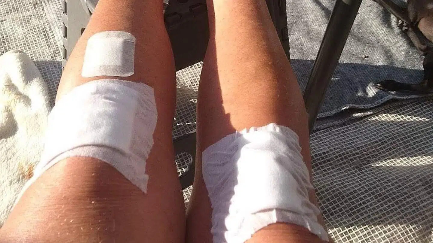 Da Kim Hansens kone skulle behandles efter et fald under ferien i Italien, blev de mødt af et skilt, der øger mistanken om en decideret svindel af turister.