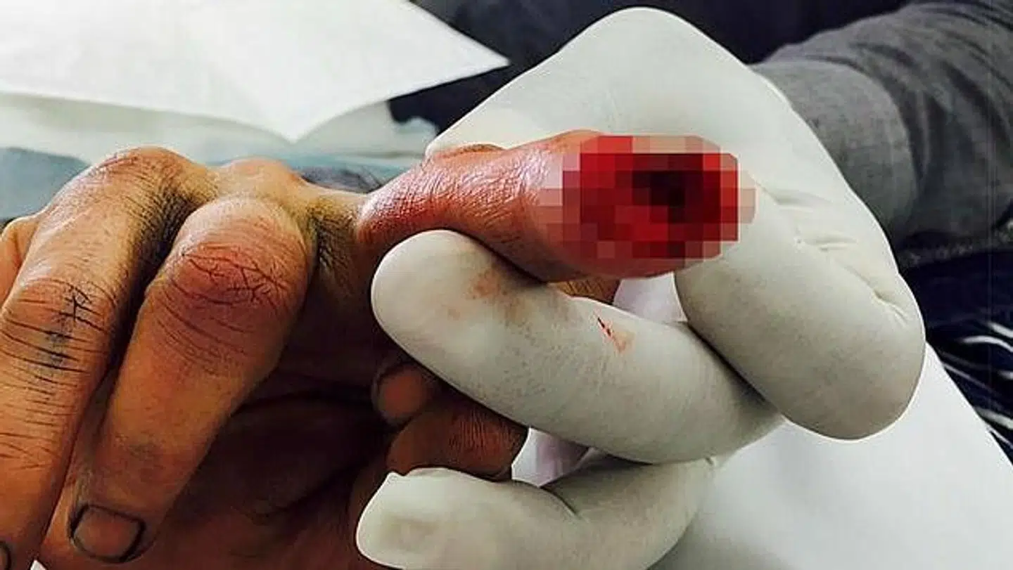 Johnny Depp var efter eget udsagn i livsfare efter sin fingerskade, fordi han tre gange fik MRSA. (Foto: Fairfax Court)