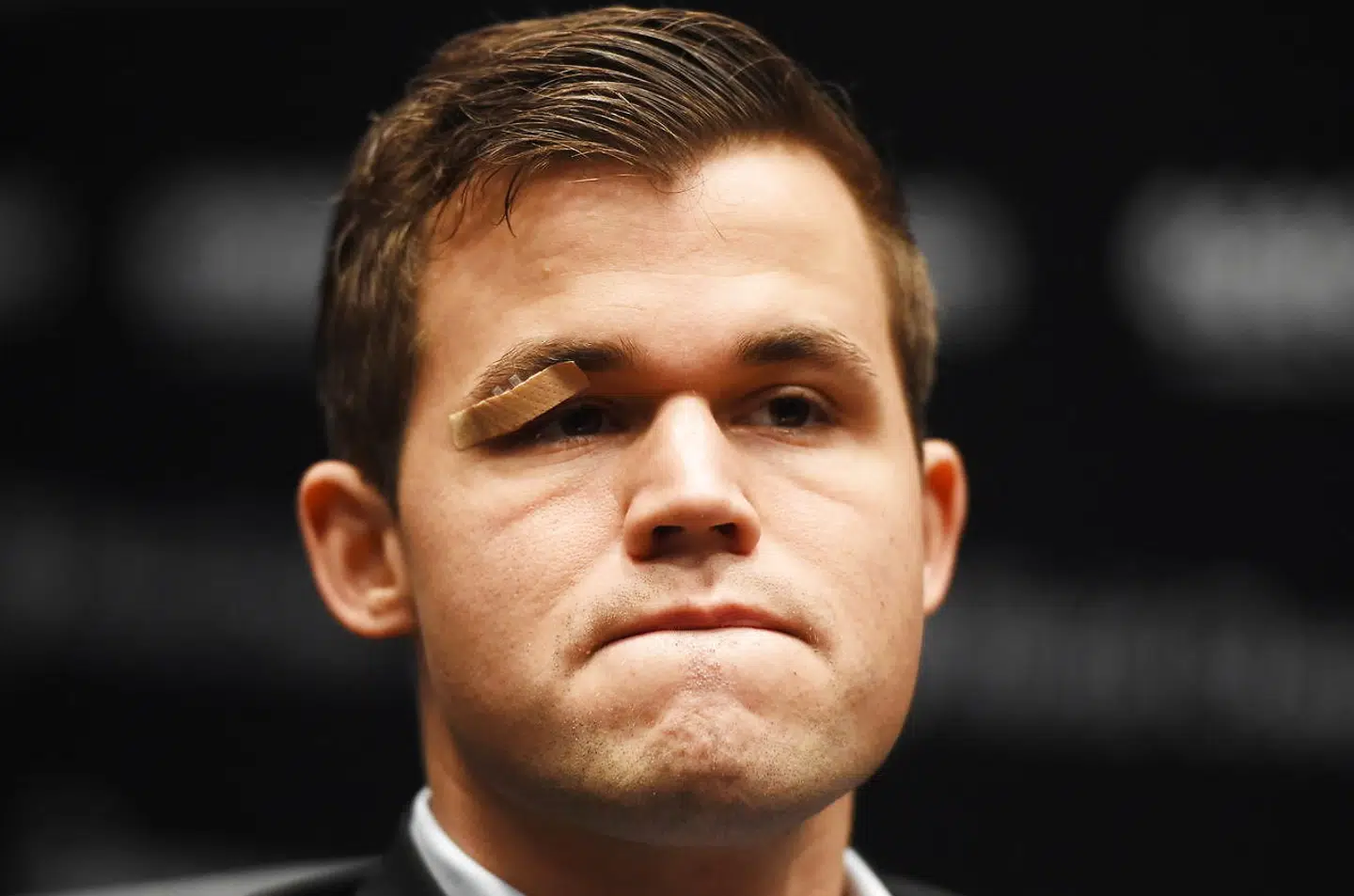 Magnus Carlsen med sin øjenskade.