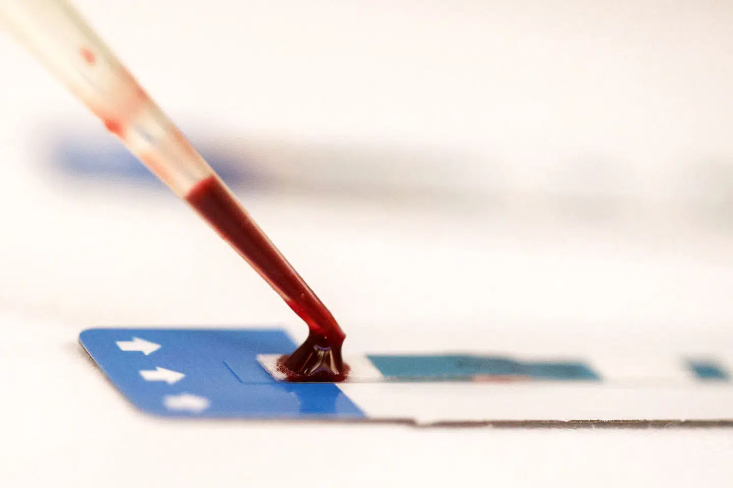 FILE PHOTO: A nurse tests a blood sample during a free HIV test at a blood tests party, part of a campaign to prevent HIV infection among male same-sex couples, in Bangkok September 20, 2014. REUTERS/Athit Perawongmetha/File Photo