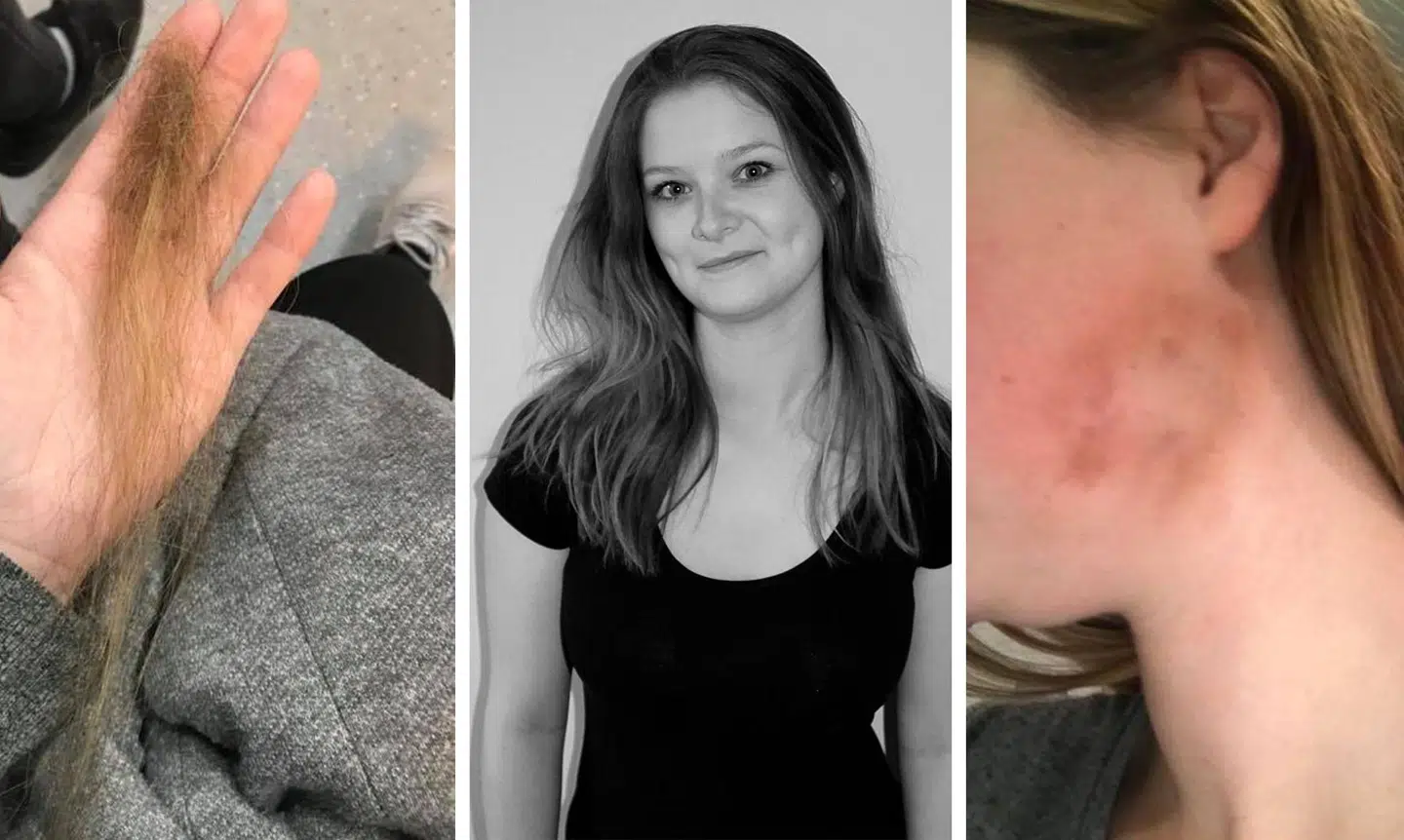 Janni blev overfaldet i november, men politiet har valgt at standse efterforskningen.