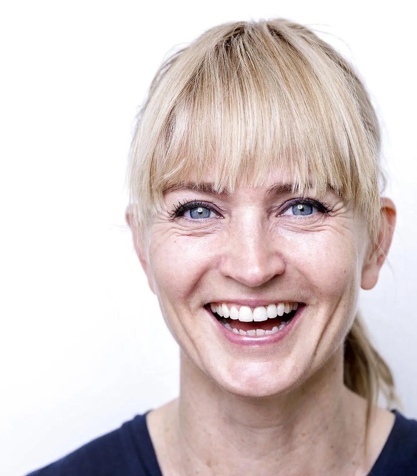 Annette har altid talt åbent om de behandlinger, hun får lavet.