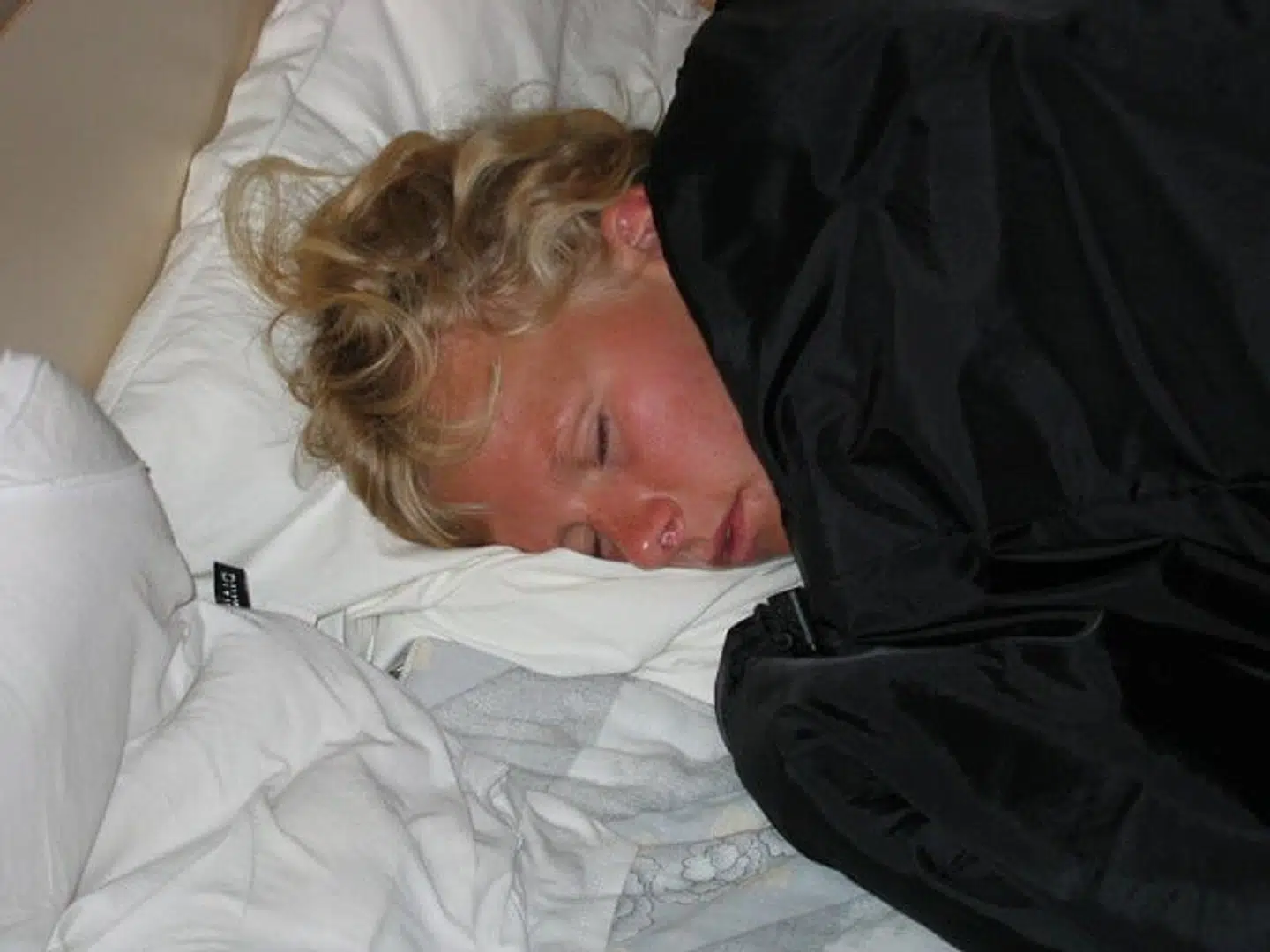 Som 24-årig fik Signe Bak Klit livmoderhalskræft. Hun fik fjernet både æggestokke og livmoder og kunne derfor ikke blive mor.