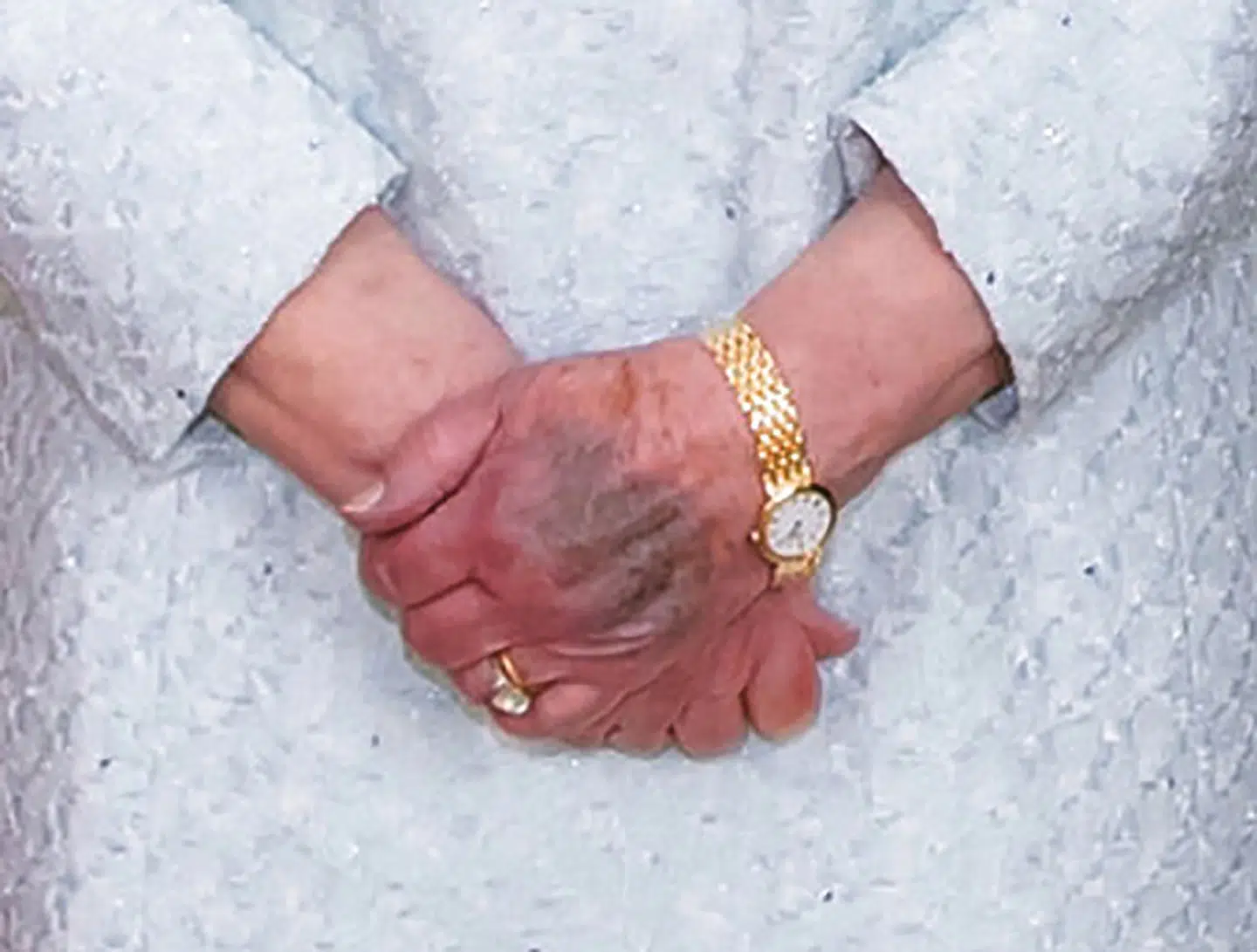 Her kan man se, hvordan majestætens venstre hånd er tydeligt blå eller lilla.