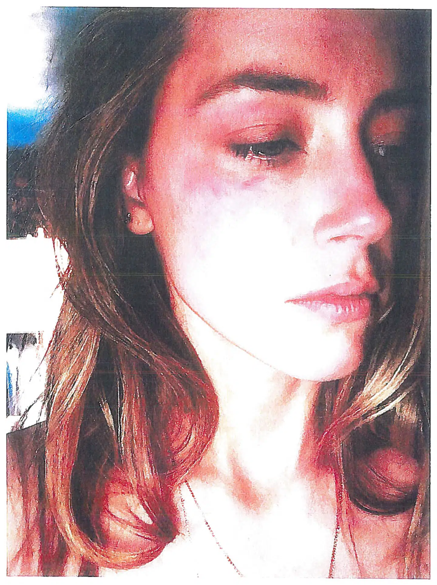 Amber Heard vedlagde dette billede, da hun i 2016 gik til politiet og fortalte, at hun fik tæv af Johnny Depp.