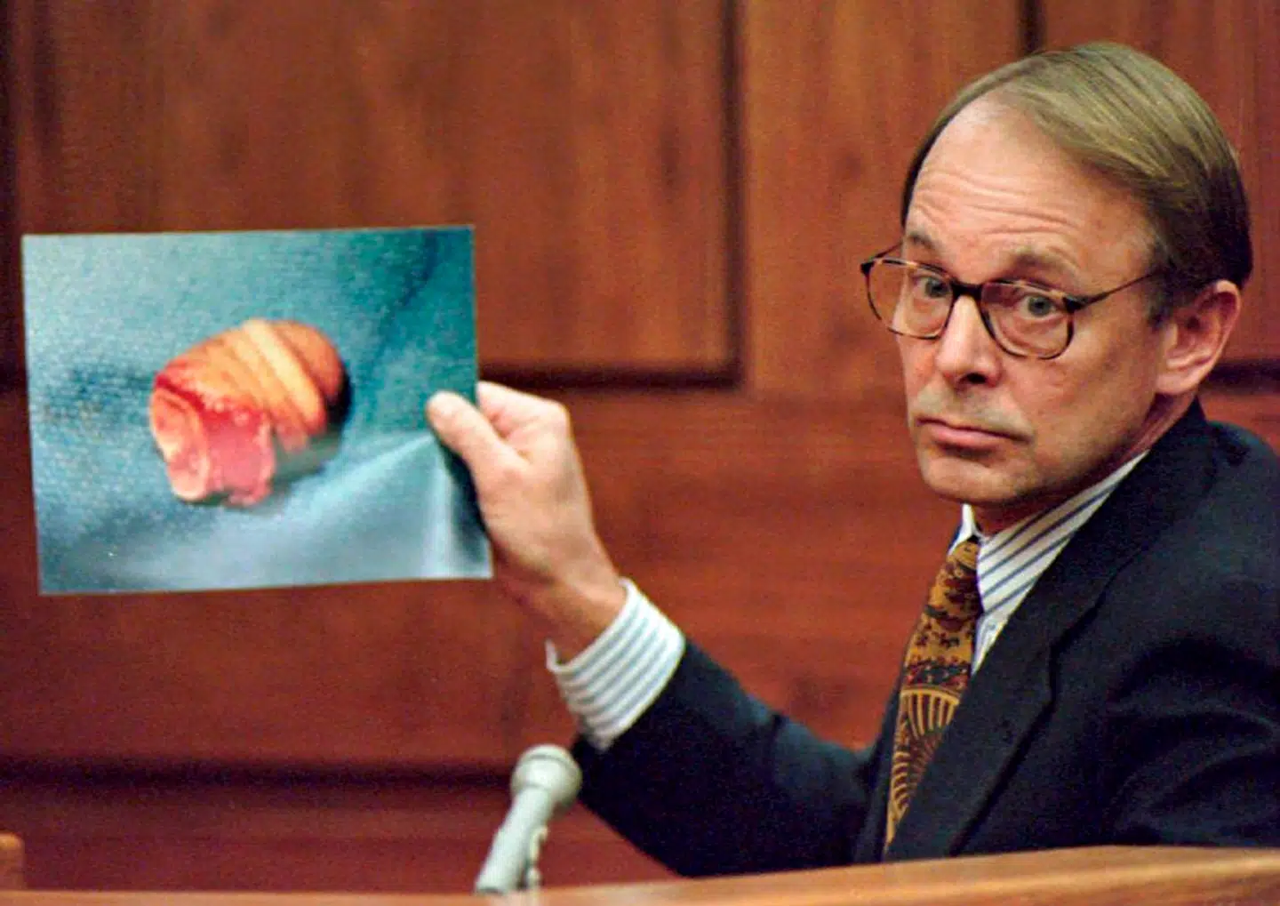 Dr. James T. Sehn fremviser et billede John Wayne Bobbitts afhuggede penis under retssagen.